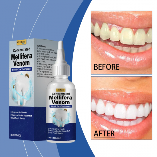 Hyaluronic Acid Toothpaste Effectively Removes Tartar, Cleans Oral ...